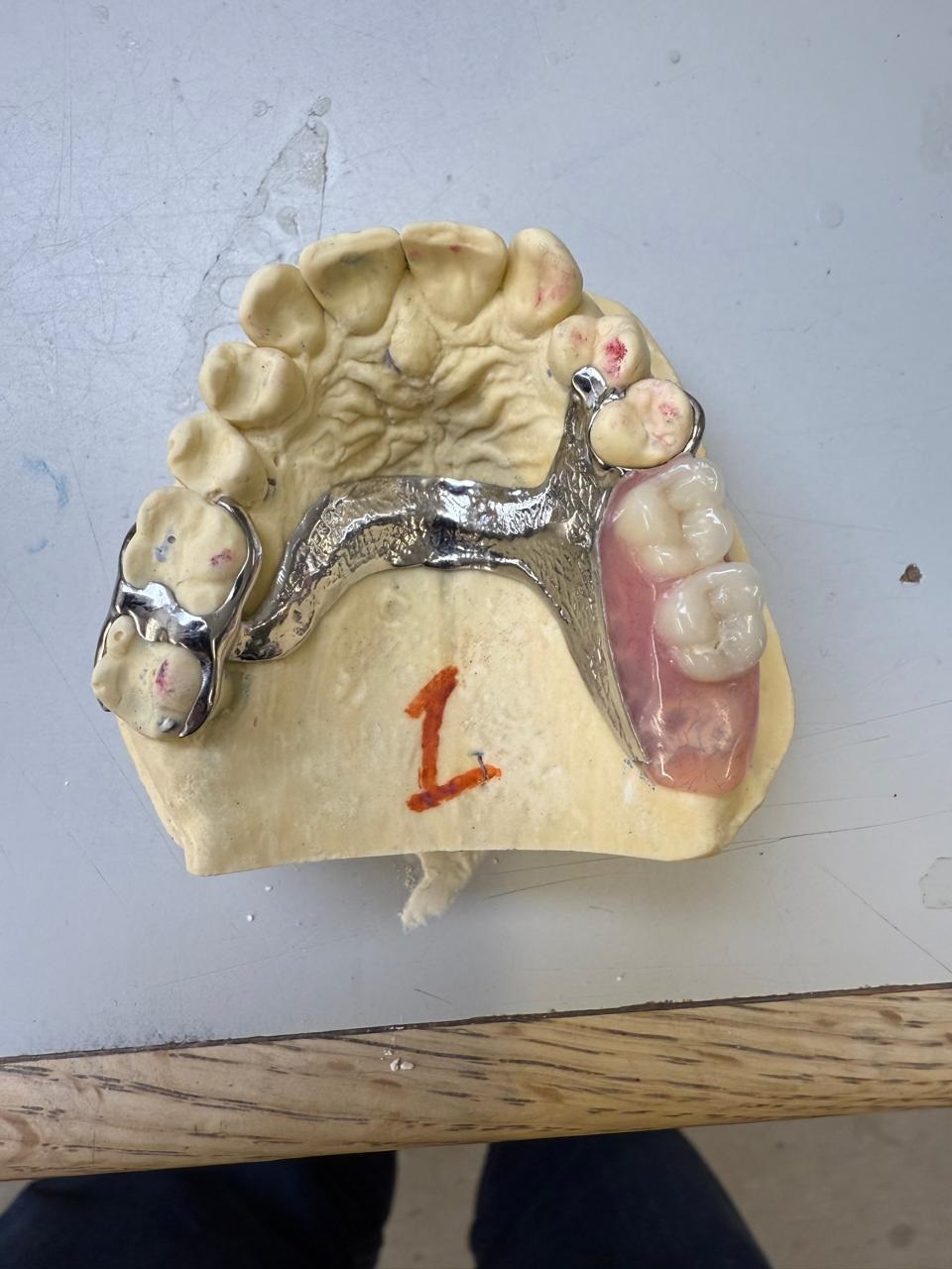 C/C 1 TOOTH DENTURE